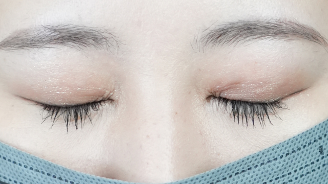 Postoperative Condition Part 1