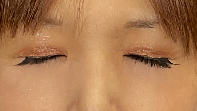 Postoperative Condition Part 1