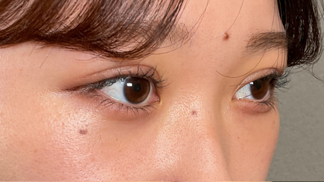 Postoperative Condition Part 1