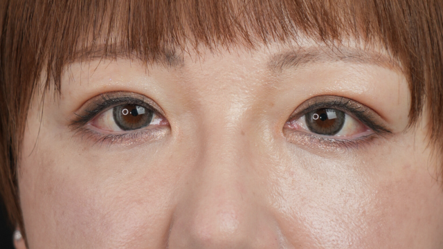 Postoperative Condition Part 1