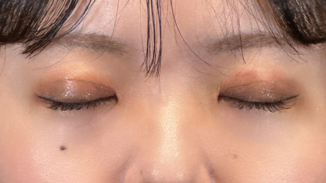 Postoperative Condition Part 1