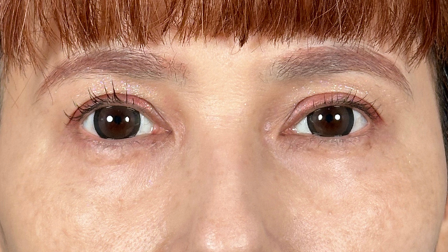 Postoperative Condition Part 1