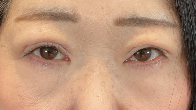 Postoperative Condition Part 1