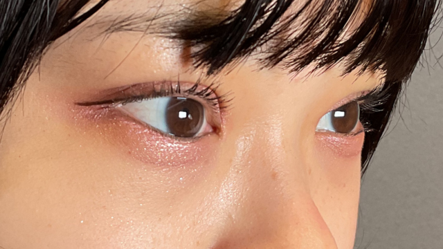 Postoperative Condition Part 1