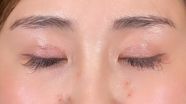 Postoperative Condition Part 1