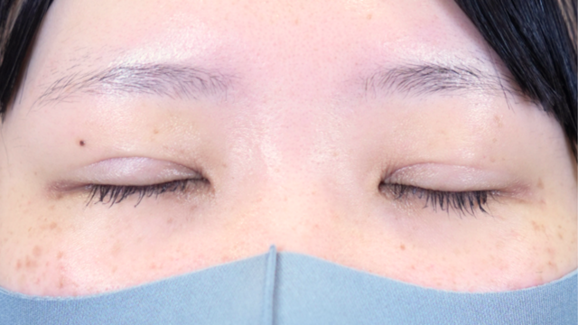 Postoperative Condition Part 1