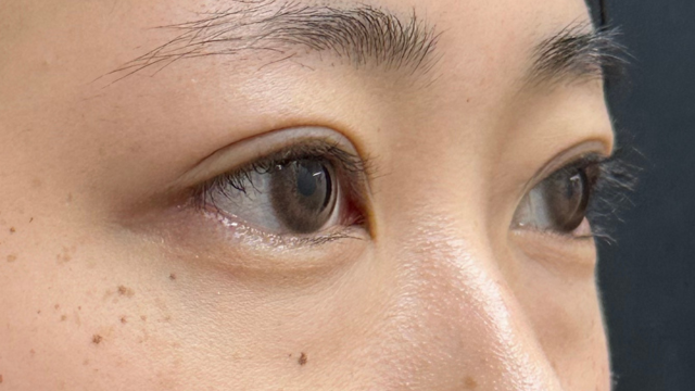 Postoperative Condition Part 1