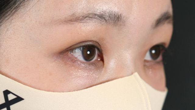 Postoperative Condition Part 1