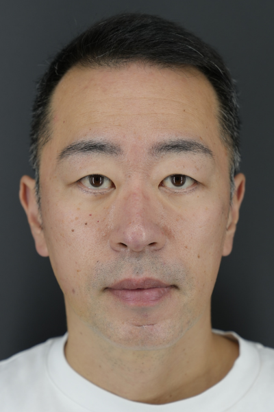 Postoperative Condition Part 1