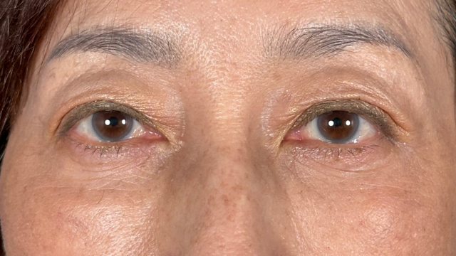 Postoperative Condition Part 1