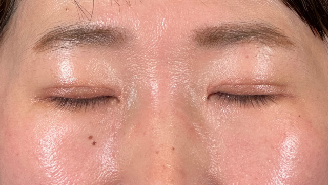 Postoperative Condition Part 1