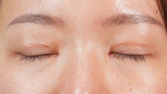 Postoperative Condition Part 1