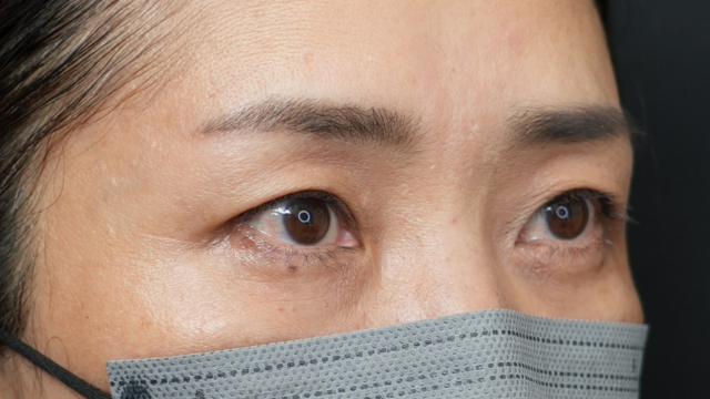 Postoperative Condition Part 1