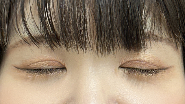 Postoperative Condition Part 1