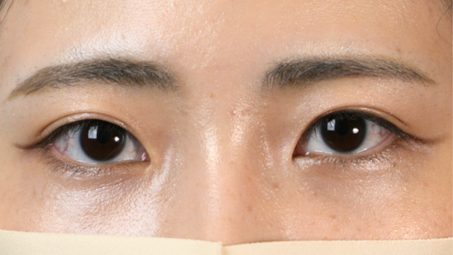 Postoperative Condition Part 1