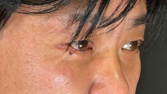 Postoperative Condition Part 1