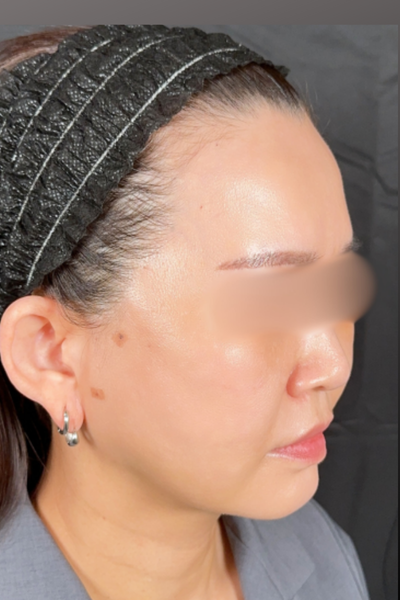 Postoperative Condition Part 1