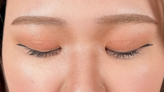 Postoperative Condition Part 1