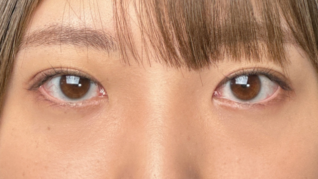 Postoperative Condition Part 1