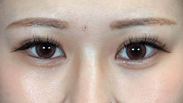 Postoperative Condition Part 1