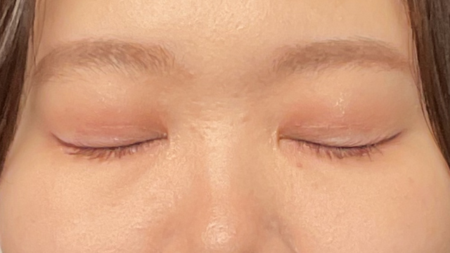 Postoperative Condition Part 1