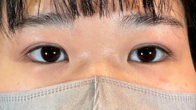 Postoperative Condition Part 1