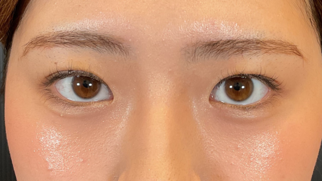 Postoperative Condition Part 1