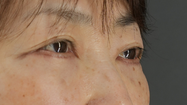 Postoperative Condition Part 1