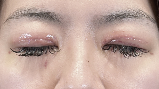 Postoperative Condition Part 1