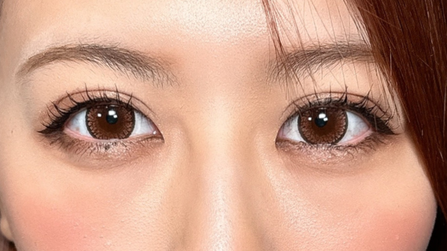 Postoperative Condition Part 1