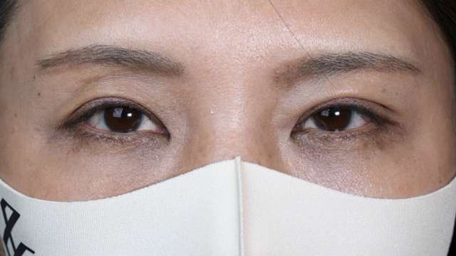 Postoperative Condition Part 1