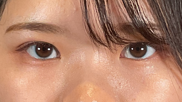 Postoperative Condition Part 1