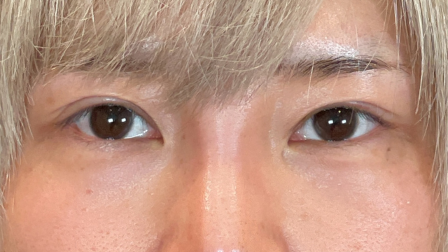 Postoperative Condition Part 1