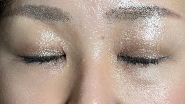 Postoperative Condition Part 1