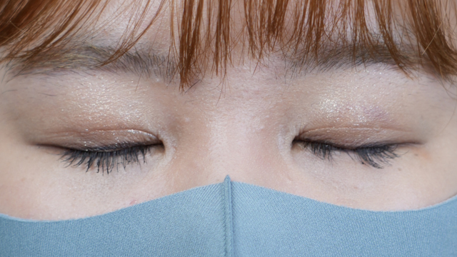 Postoperative Condition Part 1