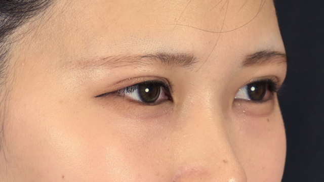 Postoperative Condition Part 1