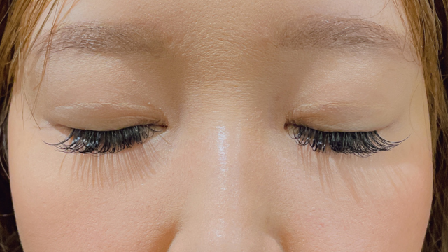 Postoperative Condition Part 1