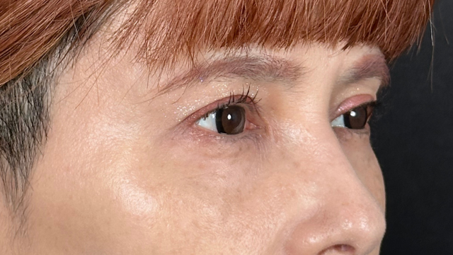 Postoperative Condition Part 1