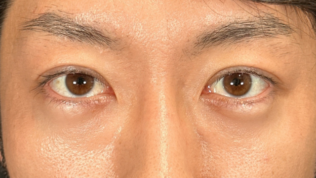 Postoperative Condition Part 1