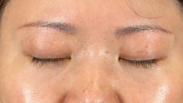 Postoperative Condition Part 1