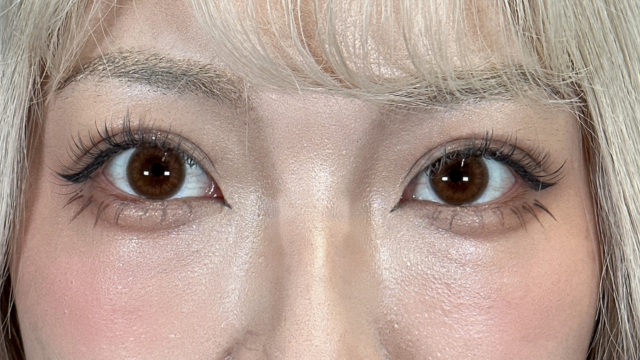 Postoperative Condition Part 1