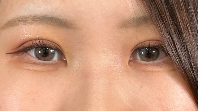 Postoperative Condition Part 1