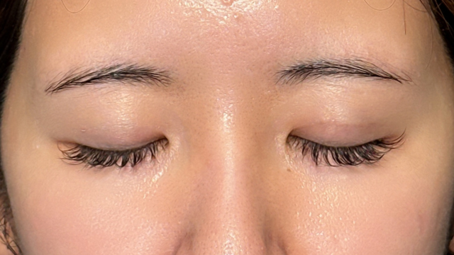 Postoperative Condition Part 1