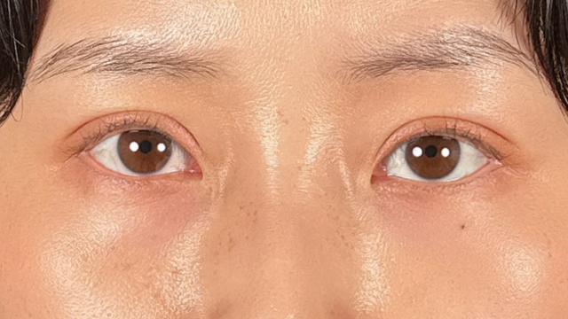 Postoperative Condition Part 1