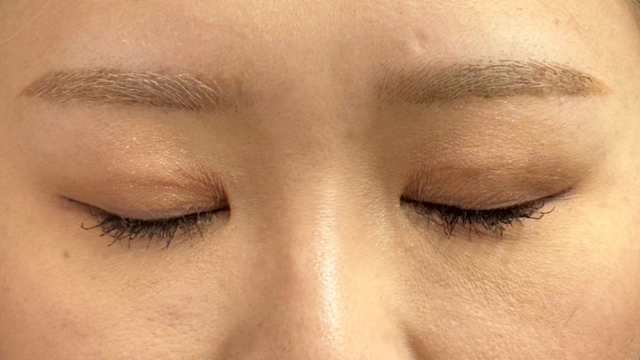 Postoperative Condition Part 1