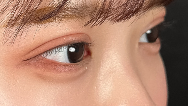 Postoperative Condition Part 1