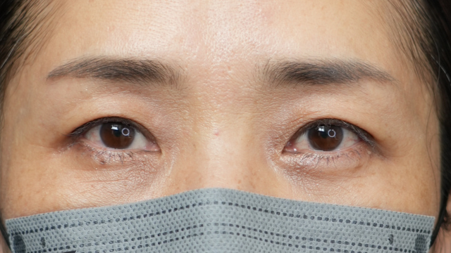 Postoperative Condition Part 1