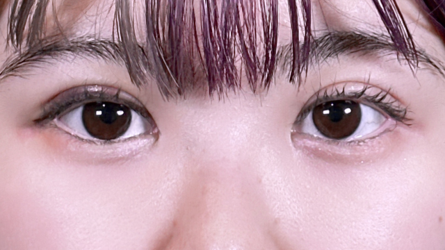 Postoperative Condition Part 1