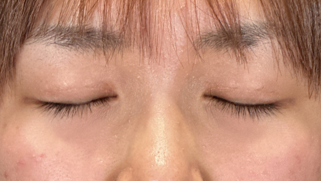 Postoperative Condition Part 1