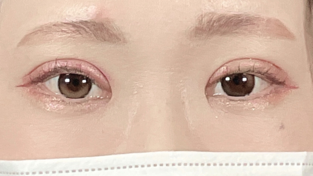 Postoperative Condition Part 1